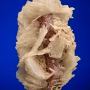 Albite var. Cleavelandite on Apatite - image 1