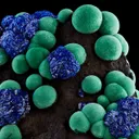 Azurite & Malachite - image 2