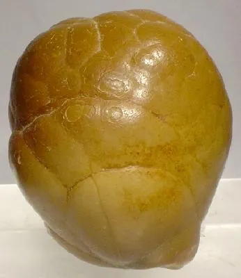 Cassiterite (Var: Wood Tin) image