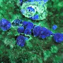 Cyanotrichite - image 4