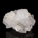 Epididymite - image 3