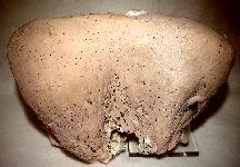 Kutnohorite image