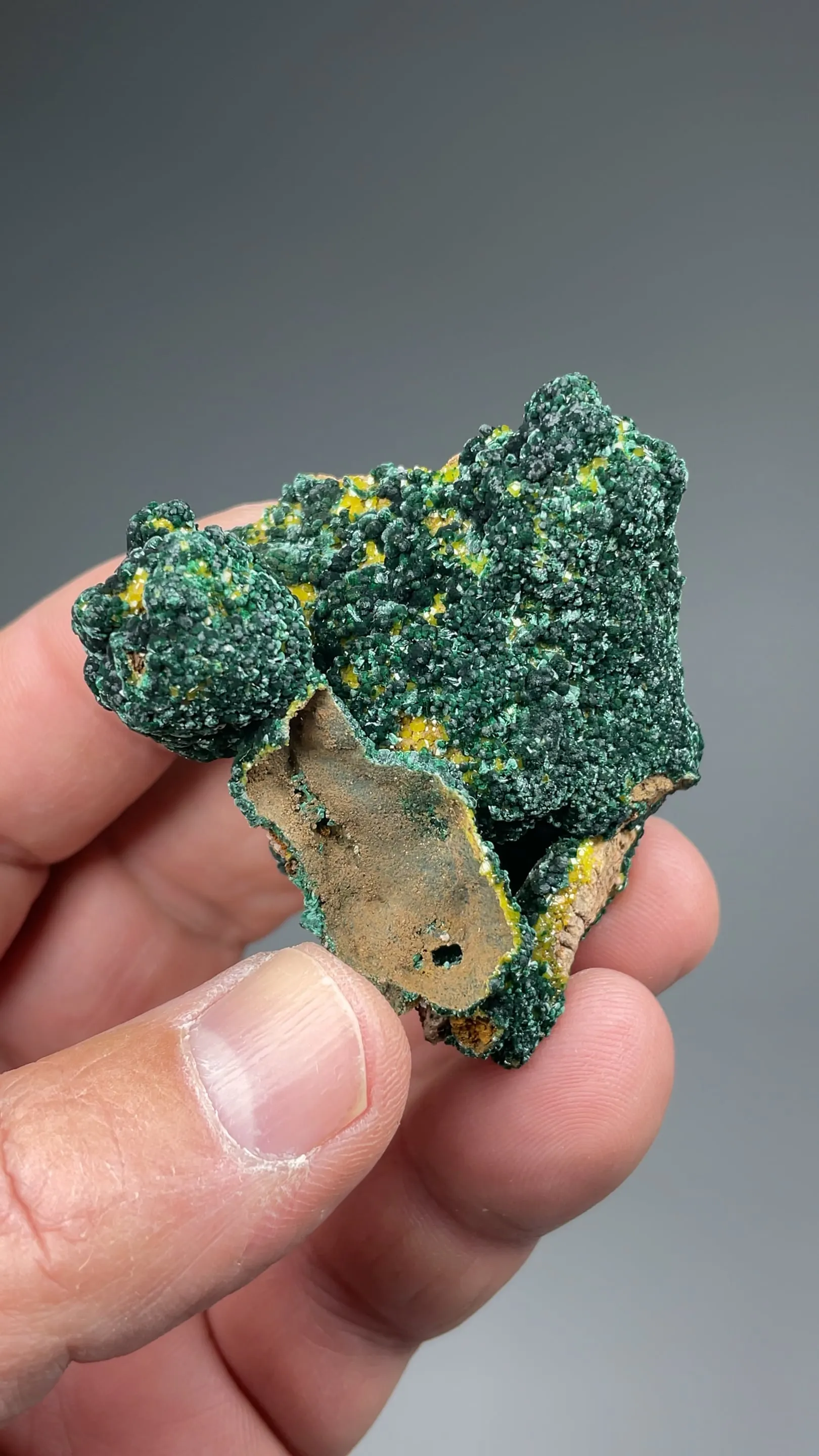 Malachite with Pyromorphite - image 2