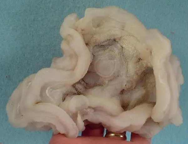 Quartz (Var: Chalcedony) image