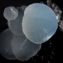 Smithsonite on Goethite - image 3